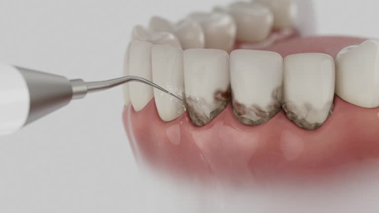 Reliable Tooth Extraction contractor in Washtenaw County County, MI by Dentist Open Now